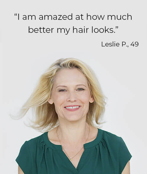 Before and After - Keranique User 5